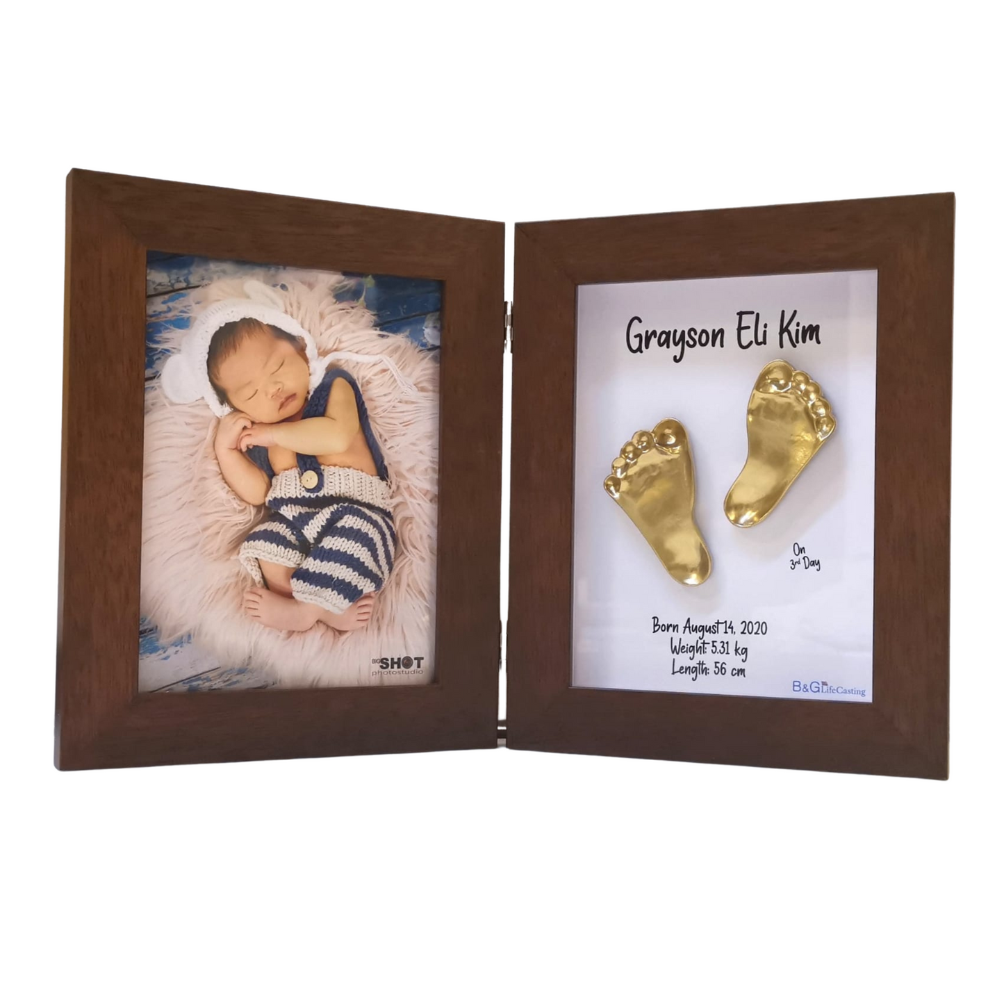 IP1A – 2 impression casts either hands or feet